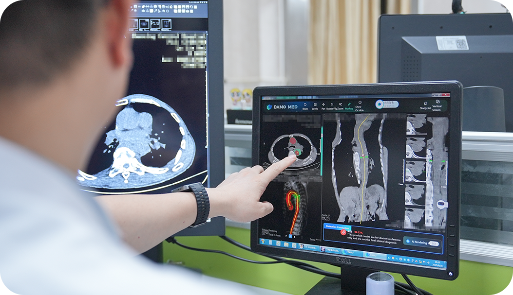 全球首个！浙大一院和阿里达摩院搞出主动脉急诊AI，专揪最要命的胸痛插图2